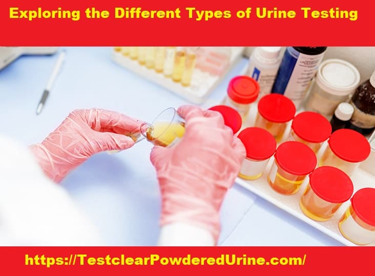 What are the 3 types of urine testing?